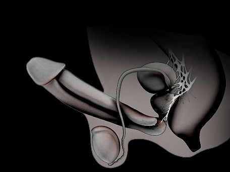 Eros Lift review no.2